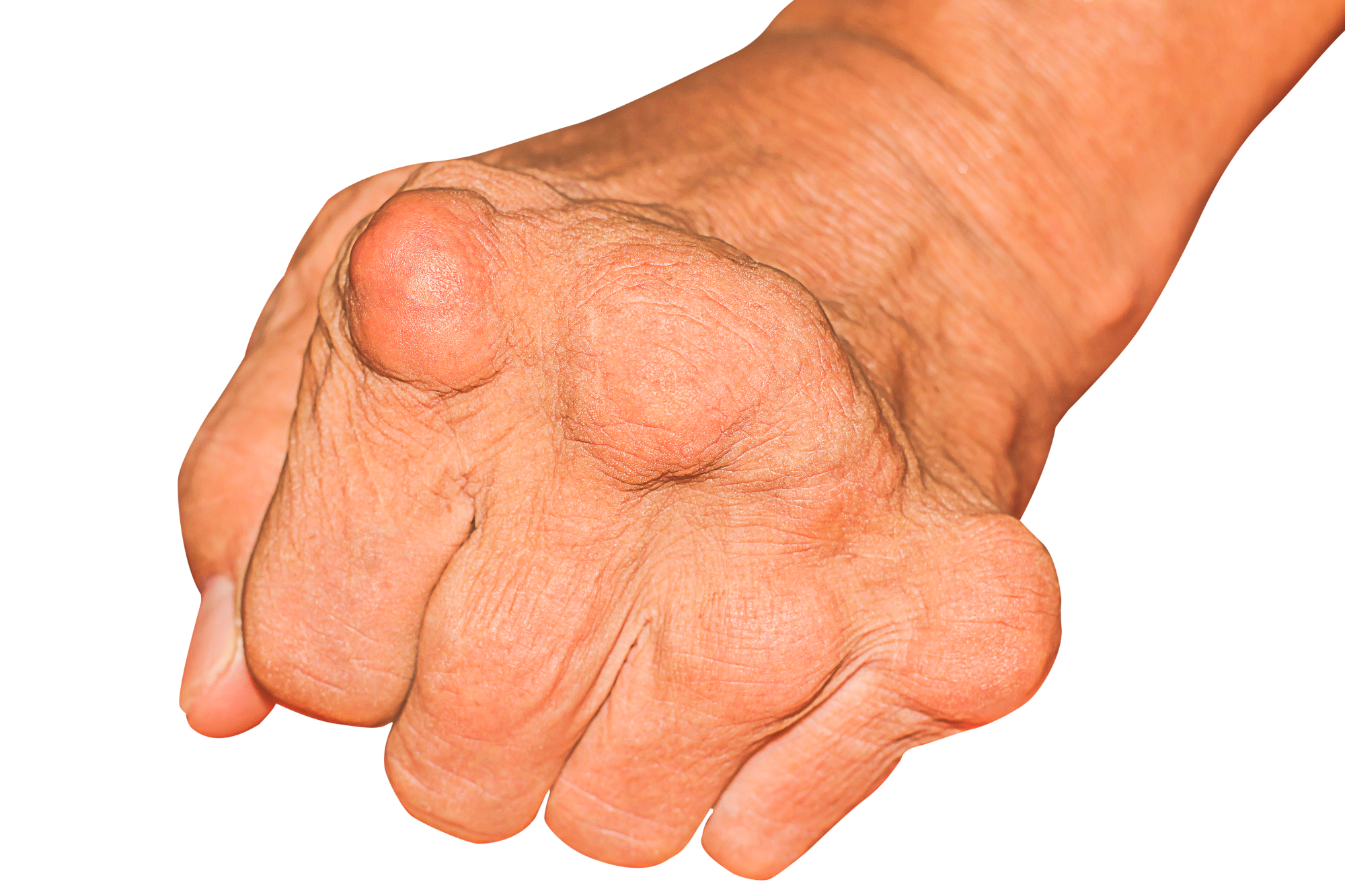 Očetu je putika preprečila nastop na finalni tekmi